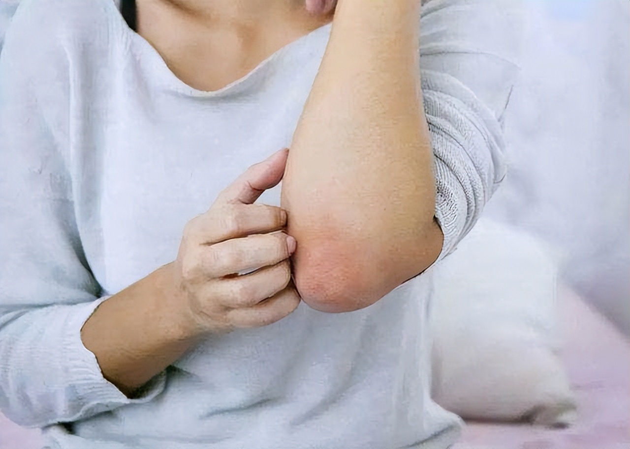 一脱秋裤就皮屑满天飞,一脱秋裤皮屑满地飞怎么办