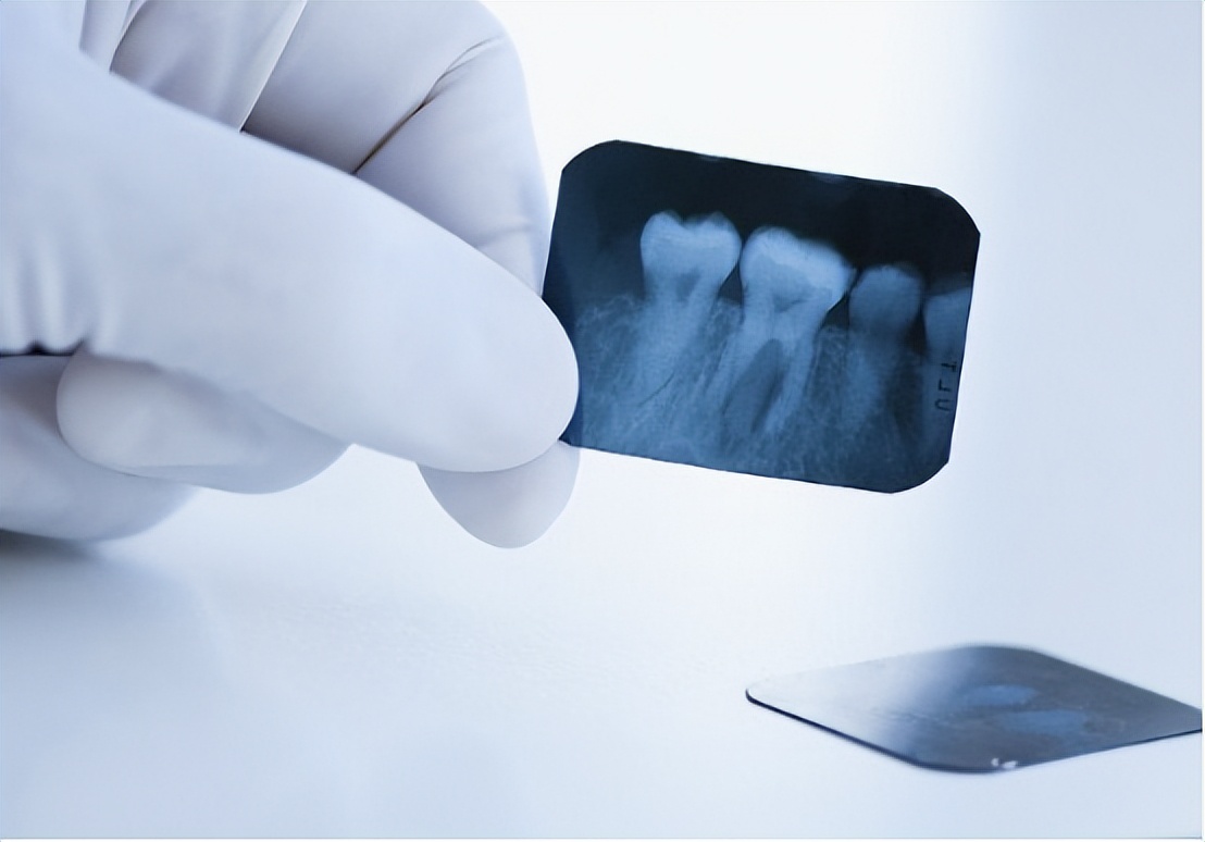 牙根纵裂怎么治疗最好,牙根病变的最好治疗方案