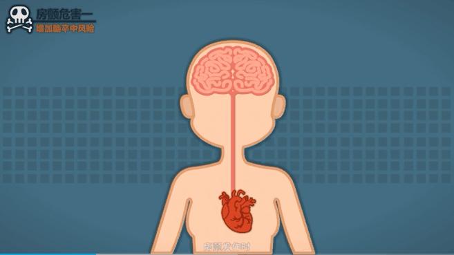 心脏缺陷导致脑梗,西安大兴医院治疗脑梗的医生