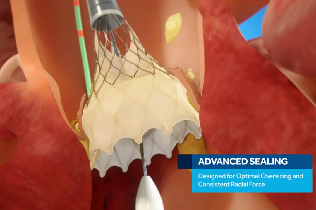 都有哪些医疗耗材已经带量采购,医疗器械最新采购政策