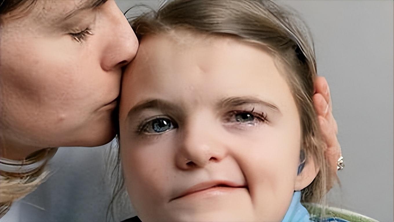 面神经麻痹后遗症的最佳治疗方法,面神经麻痹面部有麻木感觉吗