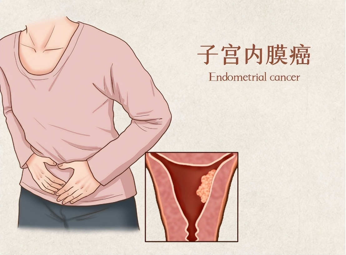 子宫性不孕症诊断与治疗,子宫发育不良性不孕确诊检查