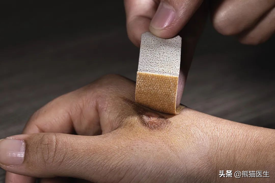 创口贴和创可贴用错会怎么样,创口贴和创可贴用错的后果