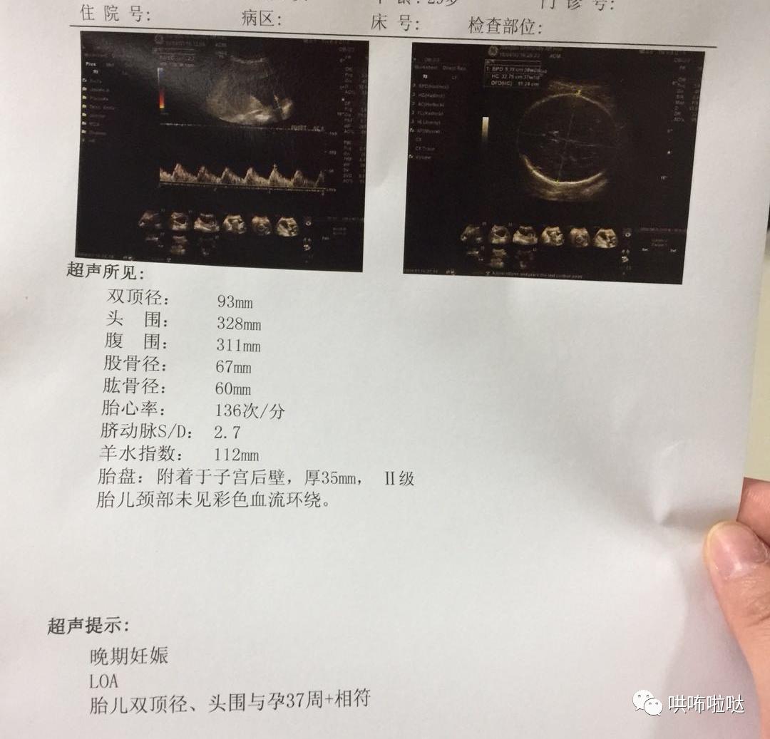 怀胎十月终于要卸货,回忆一下刚出生的宝宝