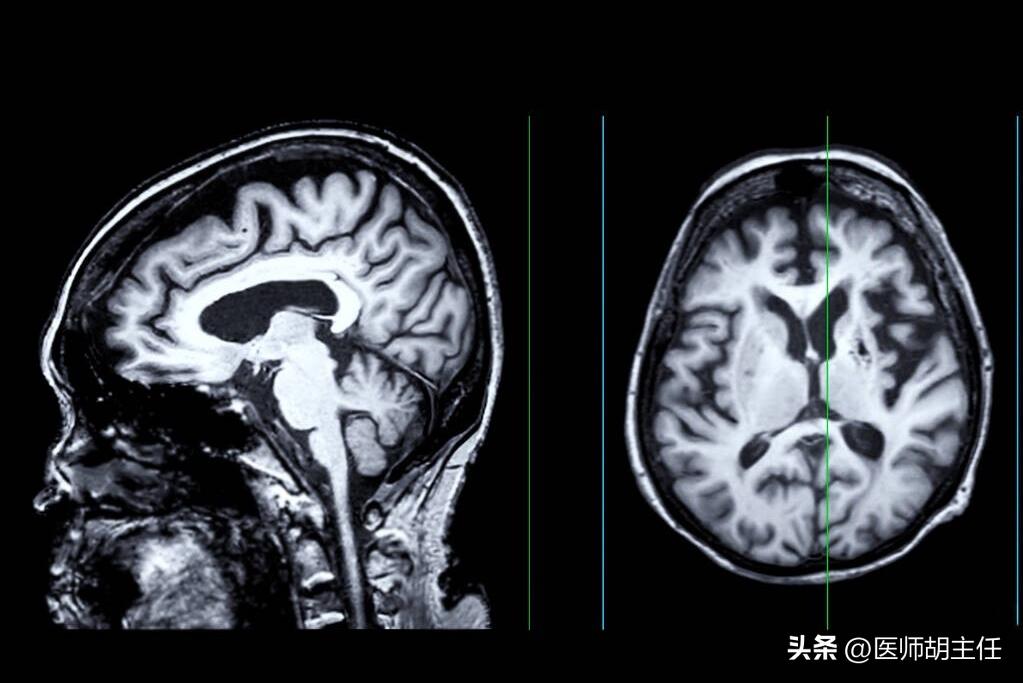 体检肝部囊肿最大2.8怎么办,体检发现肝囊肿肾囊肿