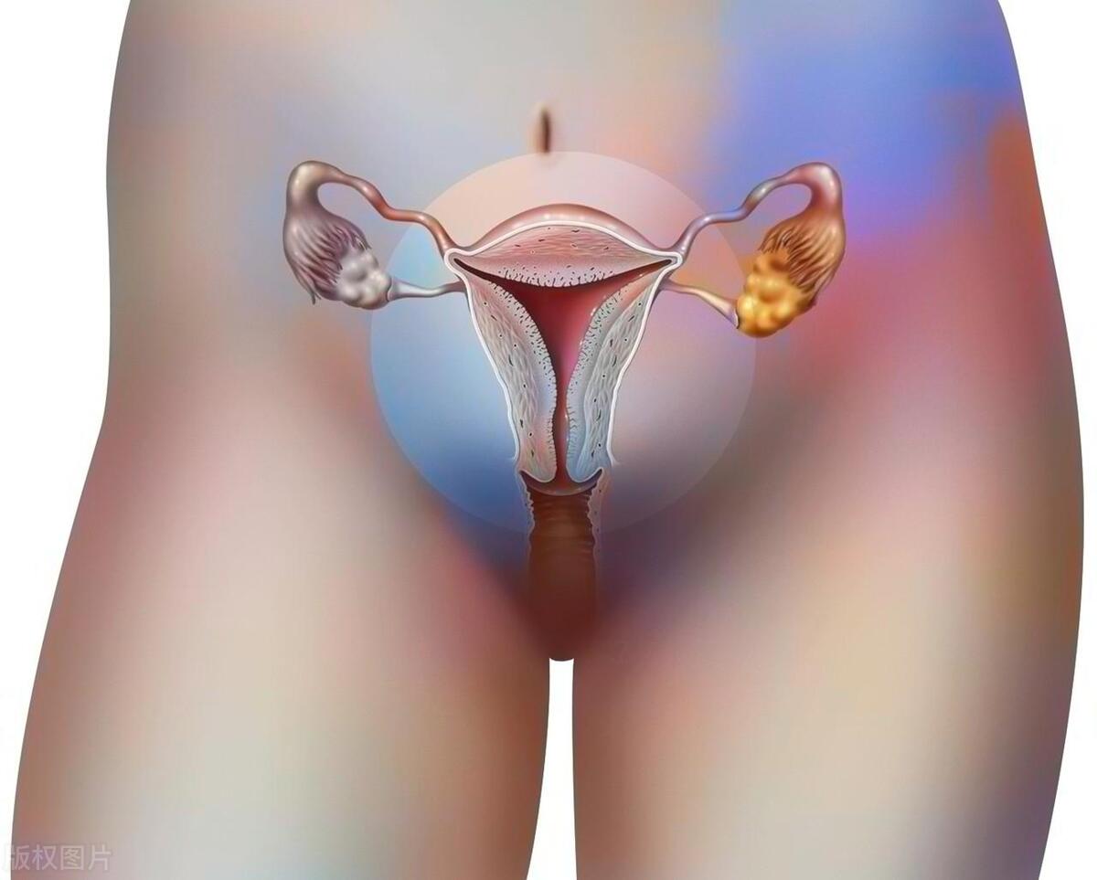 女人巨阴症是什么病,女性巨阴症可以治疗吗