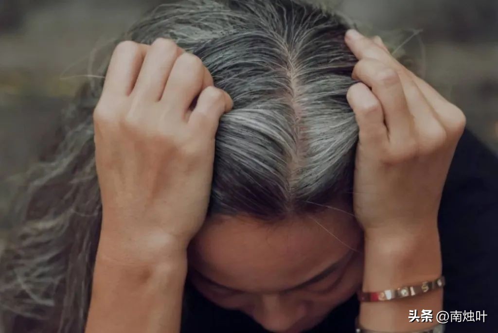 为什么压力大时会长白头发？这些习惯可以控制白发增多！