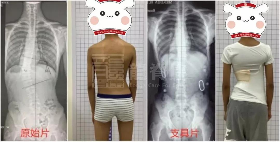 龙脊康到底是不是正规的,龙脊康蝶形可调枕定制记忆枕