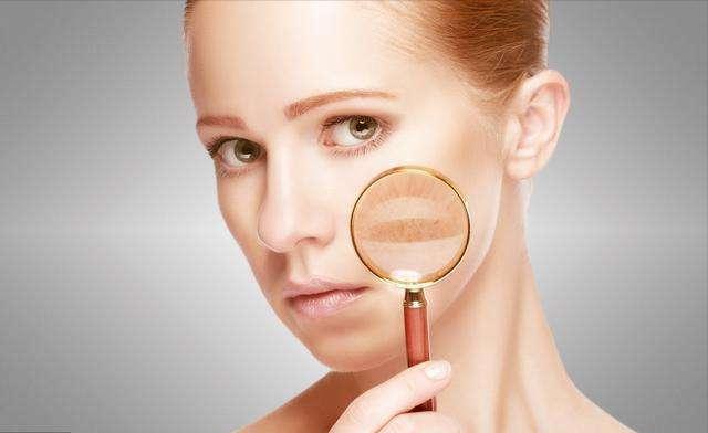 用什么方法治疗褐黄病,治褐青色斑最好办法