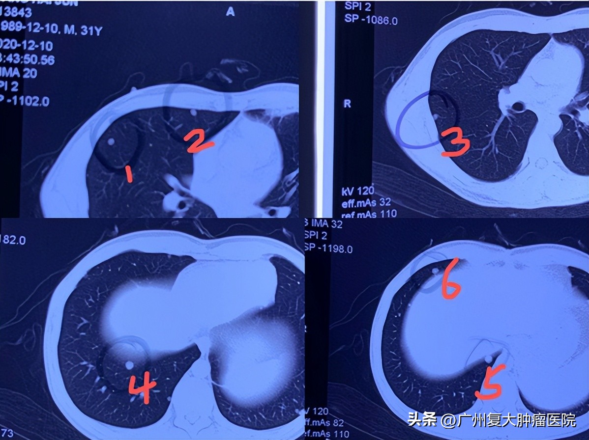 艺高人胆大完整版,艺高人胆大为病人除去痛苦