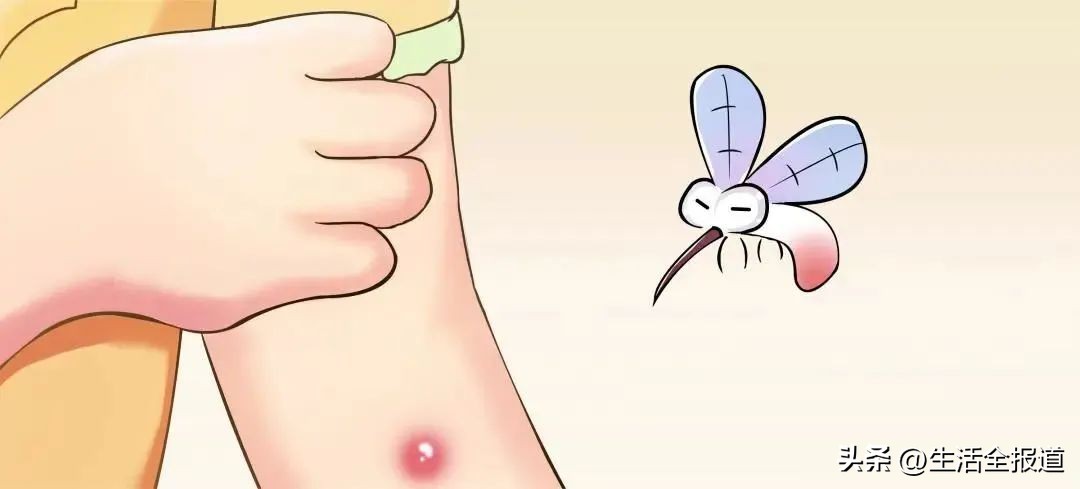 有什么老方法可以快速止痒蚊子包,怎么给蚊子包止痒