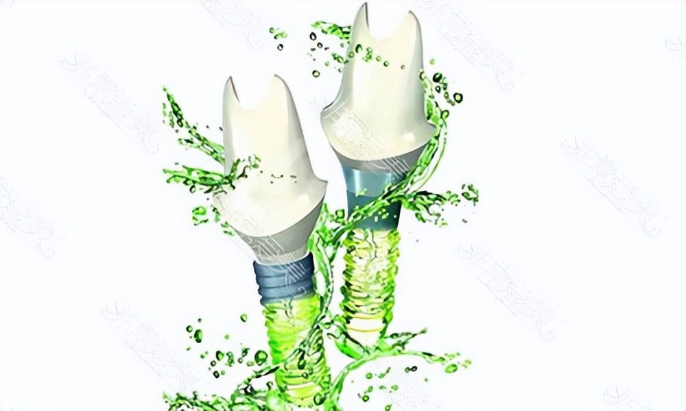 种植牙一颗多少元大概,种植牙究竟多少钱一颗