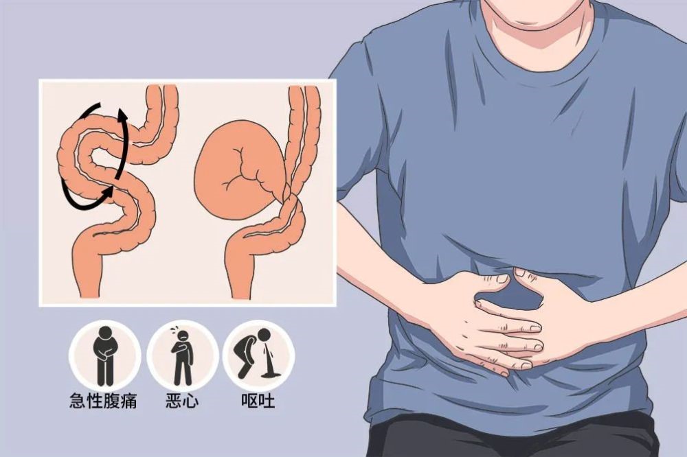 肚子疼检查说肠子堵住了,肚子疼像肠子扭在一起怎么回事