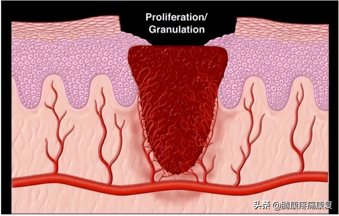 ha玻尿酸极润保湿,ha玻尿酸护肤品好吗