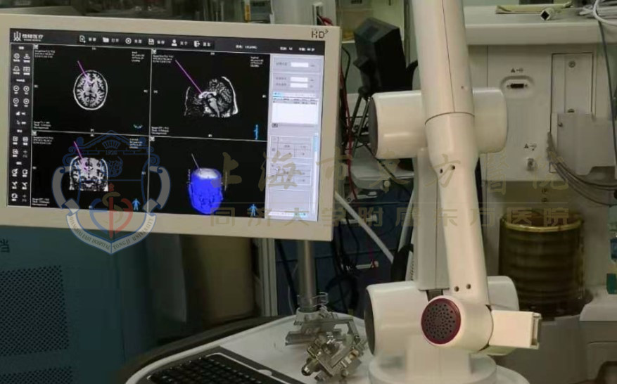 有幻觉症状就是精神分裂症吗,有幻觉跟妄想是什么病