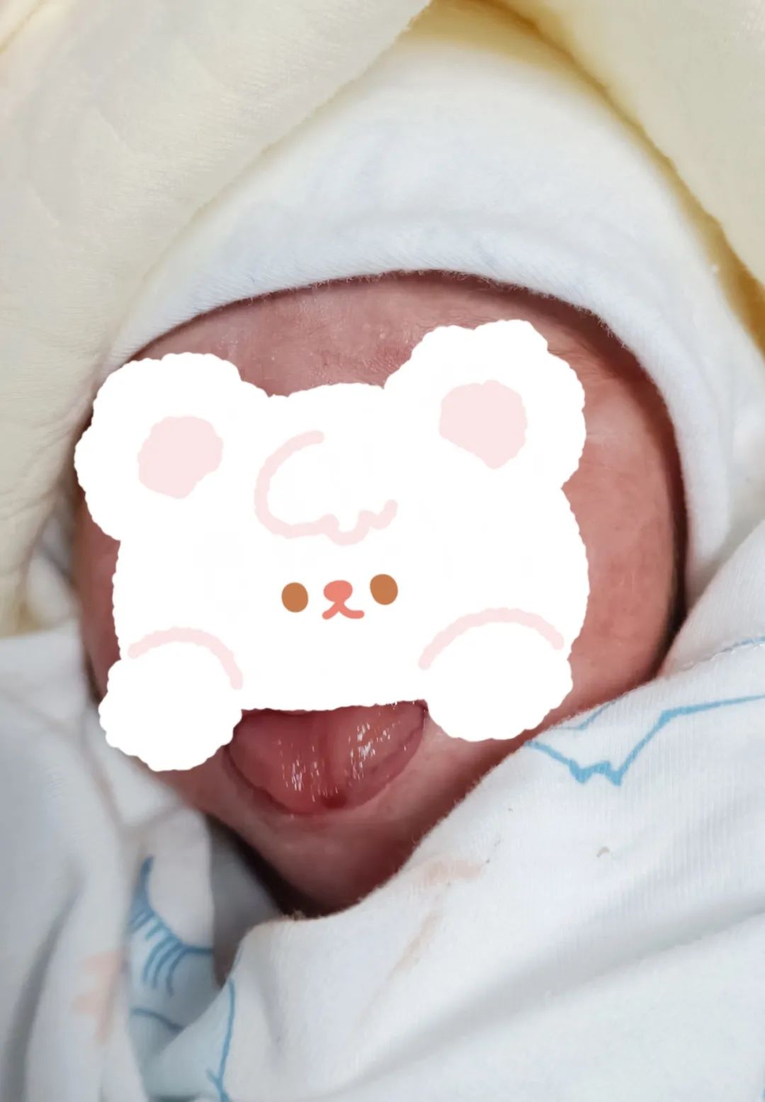 产科oct正常可以出院吗,oct阳性马上剖宫产吗