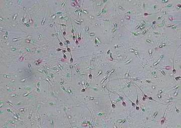 人体的精子是如何产生的,人的精子怎么样才能存活