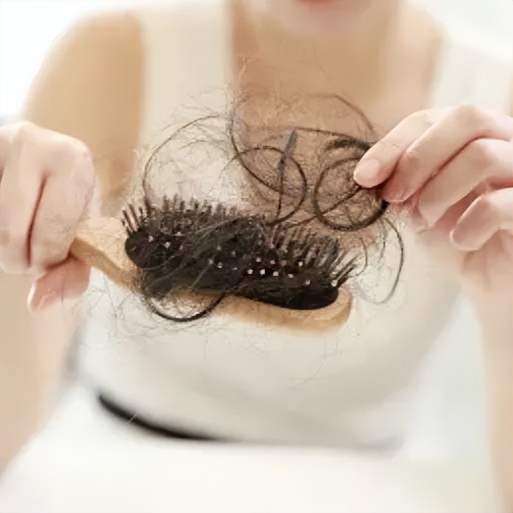 超30%阳康或有脱发风险,阳康脱发怎么办