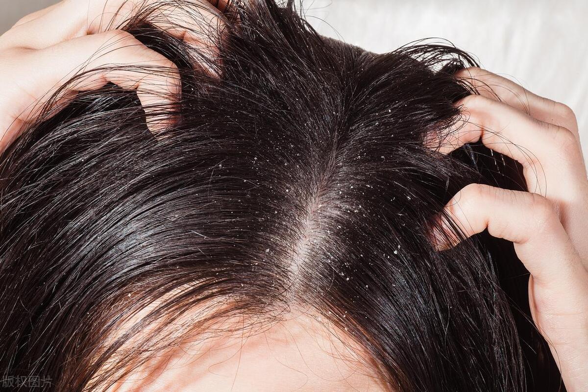 头皮经常长疙瘩什么原因,头皮总长疙瘩怎么回事手摸还疼