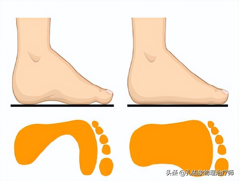 中老年人脚底痛是什么原因,老人脚底板好疼是什么原因