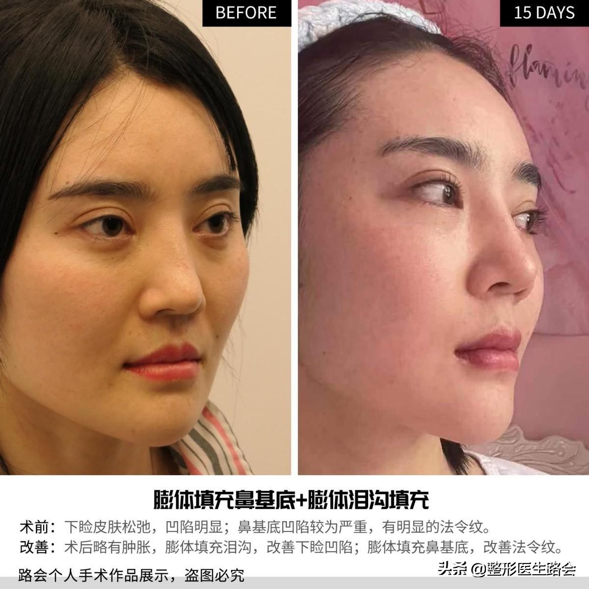 脸干有细纹显老,脸部皮肤黑显老怎么办