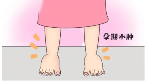 孕期水肿如何解决,孕期水肿吃什么消除