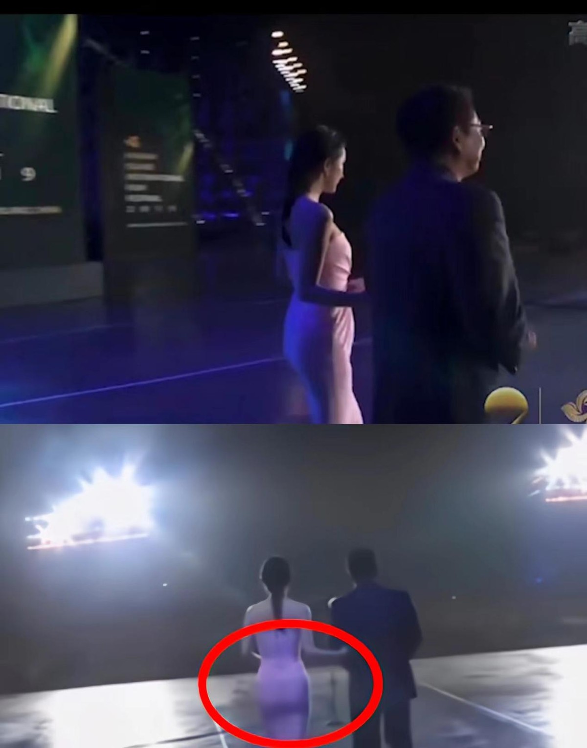 脸部造假，发量造假，牙齿造假，女明星除了性别，还有什么是真的