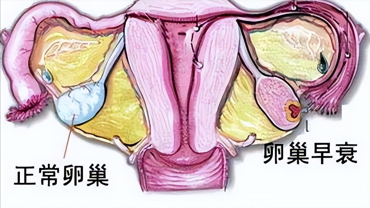 医生才知道的9种妇科问题,如何确定卵巢早衰与否