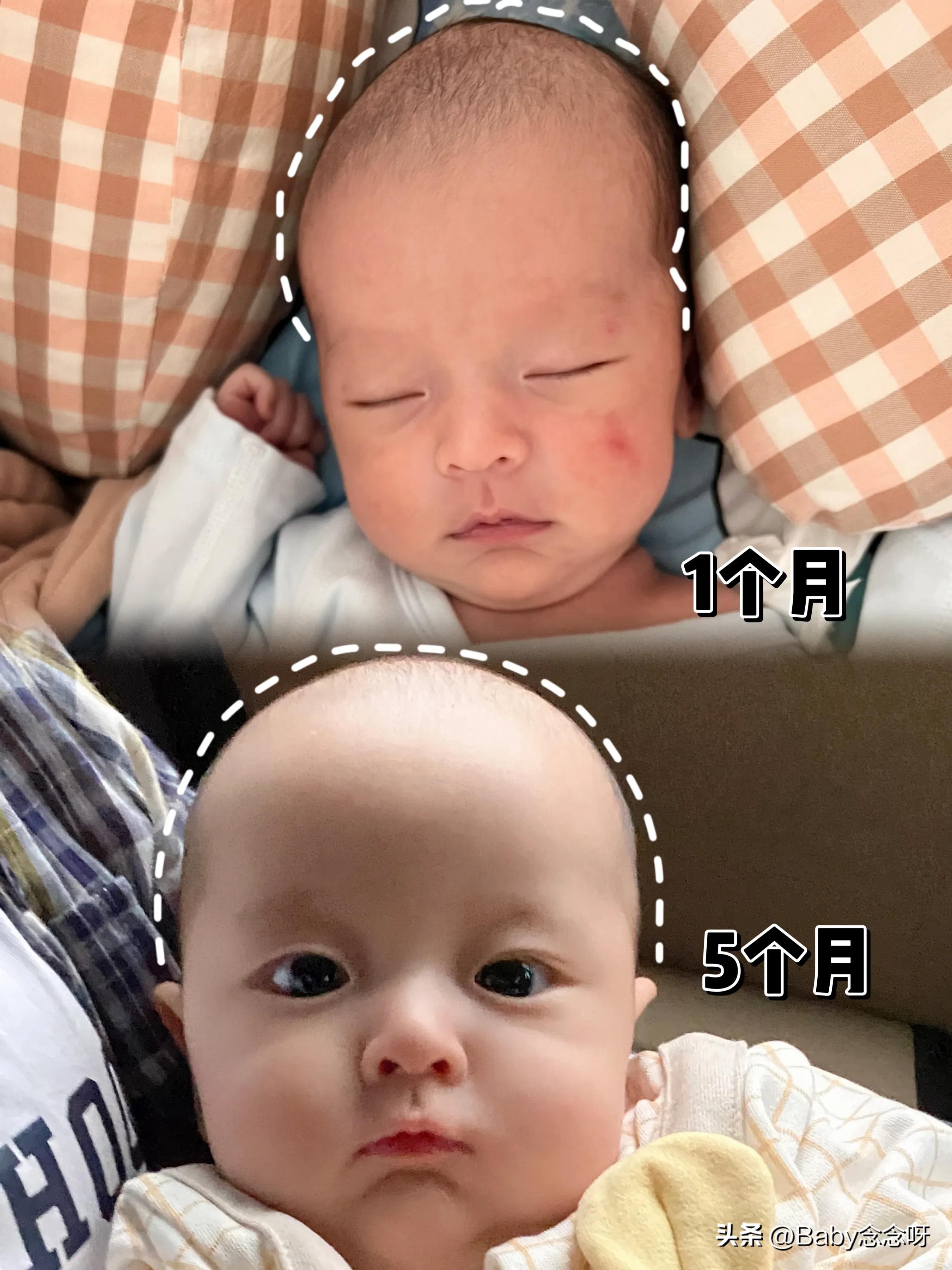 宝宝舟状头应该怎么睡能睡出圆头,手把手教五个月宝宝入睡