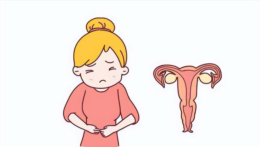 宫颈炎是什么原因引致的,宫颈炎诊断讲究三步走