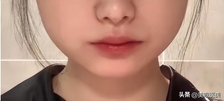 女明星都逃不过的颈纹,女明星也逃不过的身材缺陷