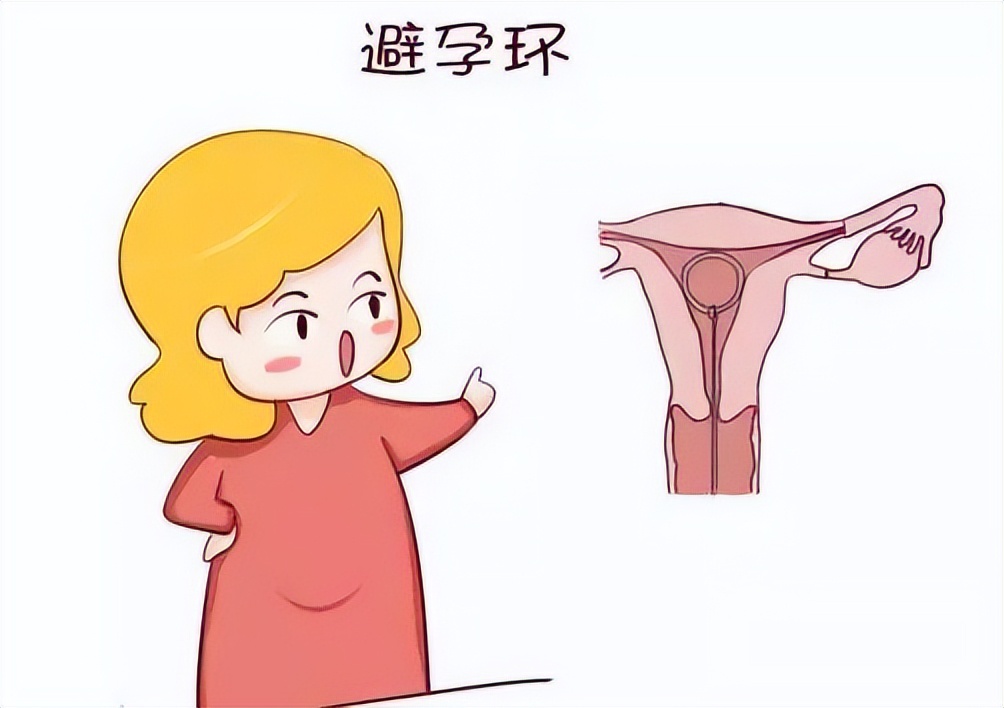 生完娃为什么非要上环,不想生小孩上环好不好