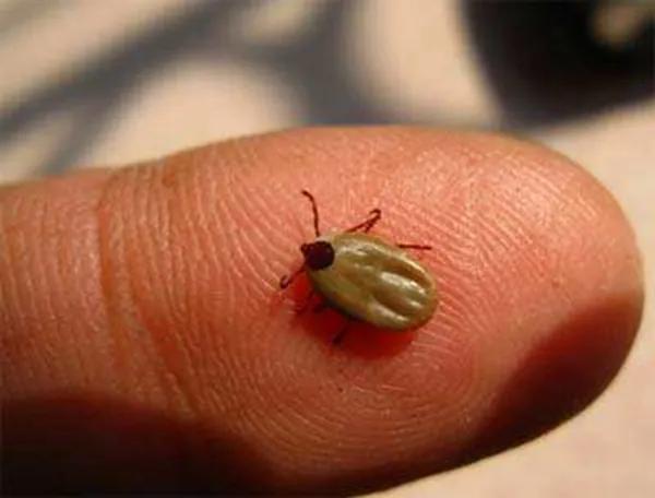 小时候头上长虱子的事,小时候头上的虱子是什么样子的