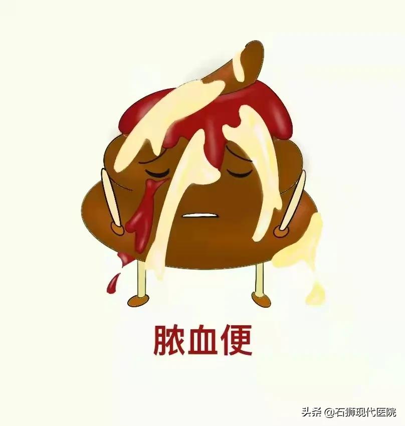 便血挂肛肠外科,便血一般肛肠外科怎么检查