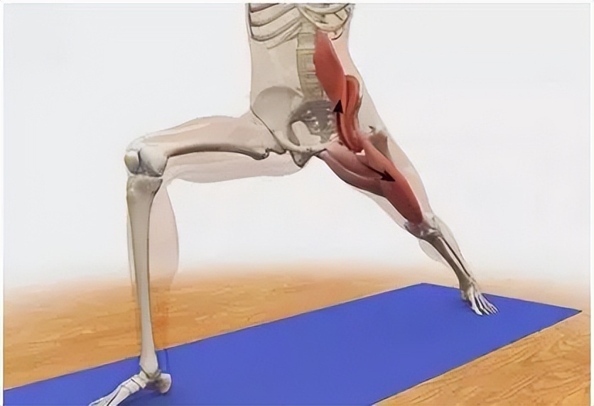 矫正骨盆后倾其实很简单,骨盆后倾矫正最简单的动作