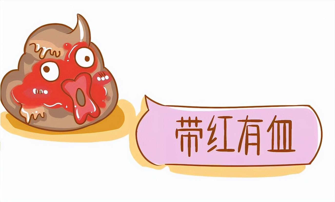 肛门附近的癌症症状,体内有癌大便先知