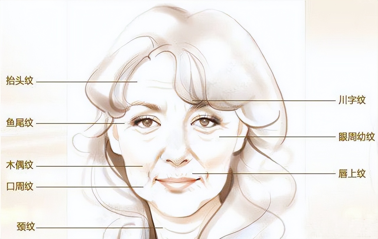 分门别类治皱纹,年轻就是快乐无限