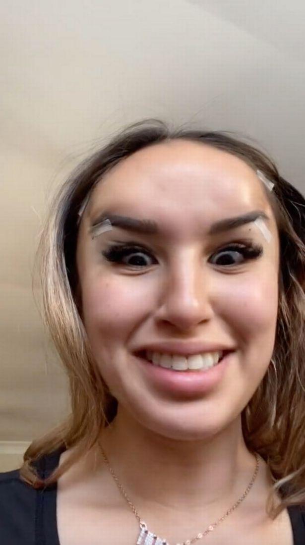 澳洲女做“狐狸眼”整容手术，结果看起来像“长着犄角的外星人”