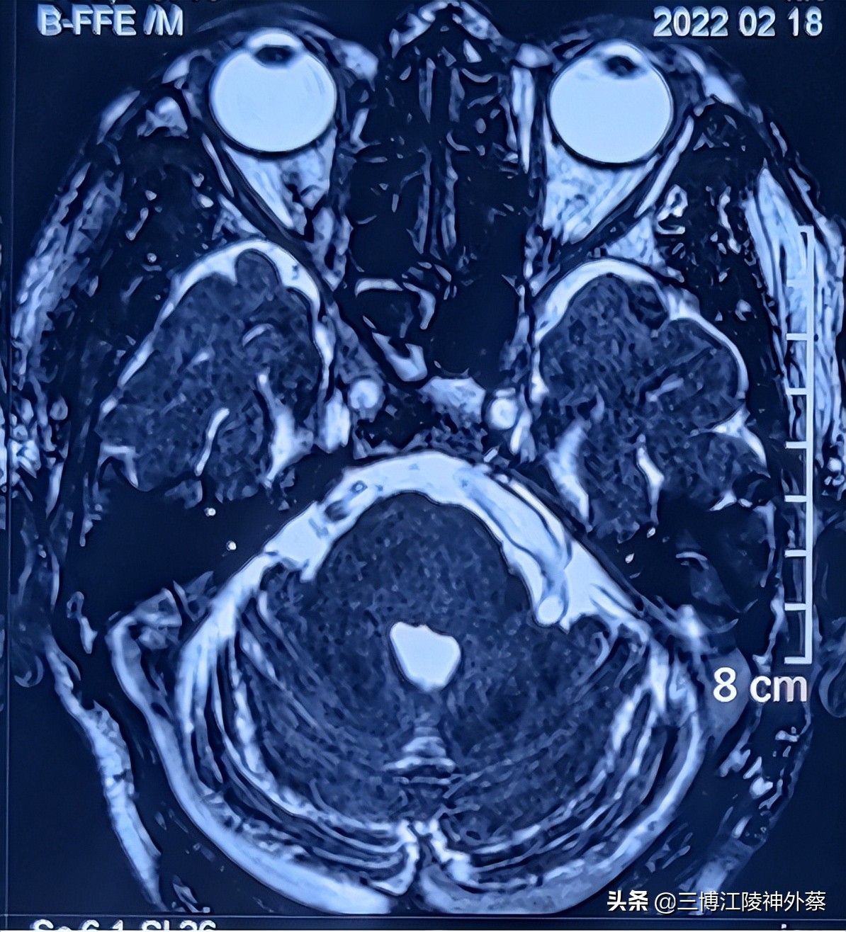 无缘无故面部疼痛怎么解决,面部有时感觉疼是什么原因