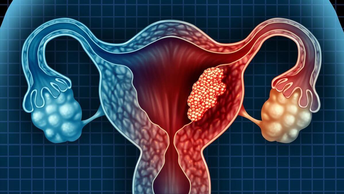 女性切除子宫后，与正常女性有何不同?看完答案，男人能接受吗?