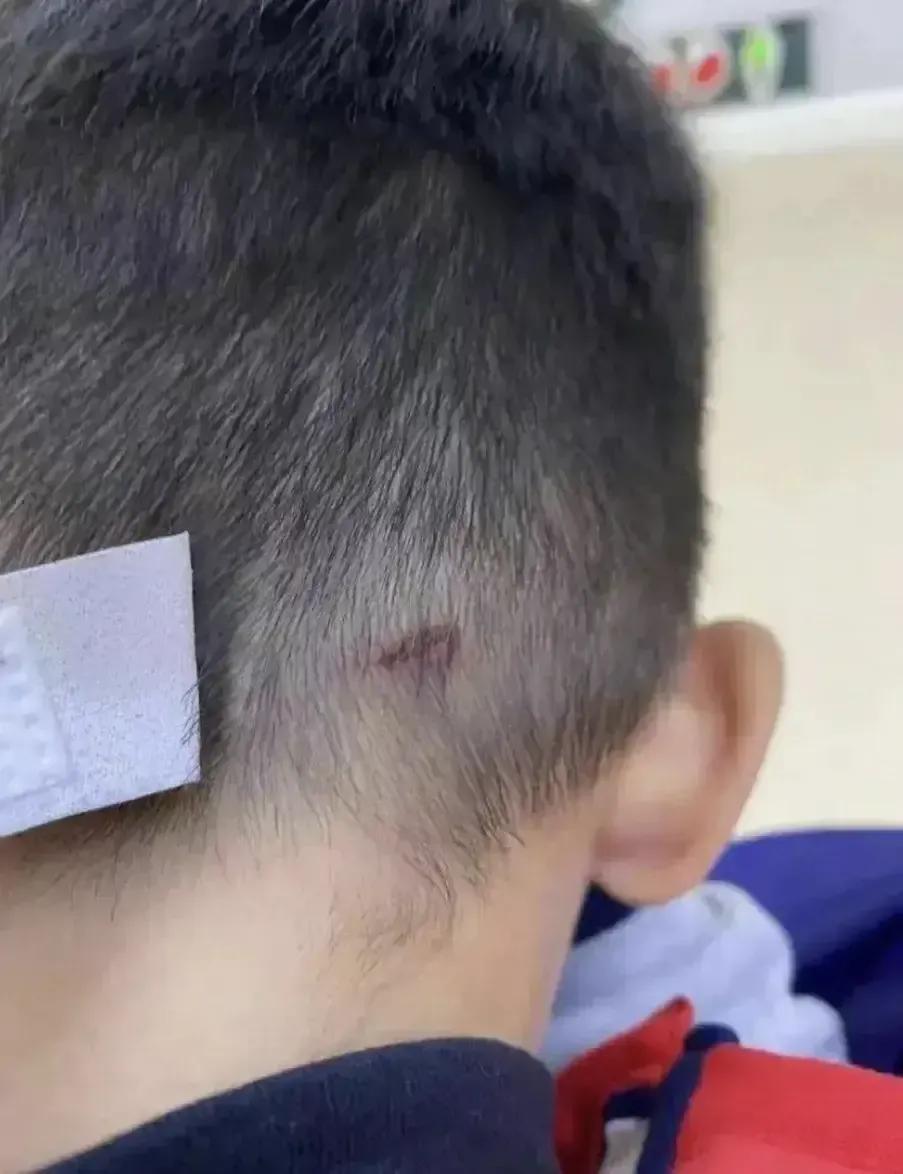 孩子砸伤别人怎么教育,孩子用铅笔戳伤别人该怎么教育