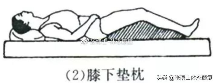 「体态康复」缓解下背痛的十六条建议