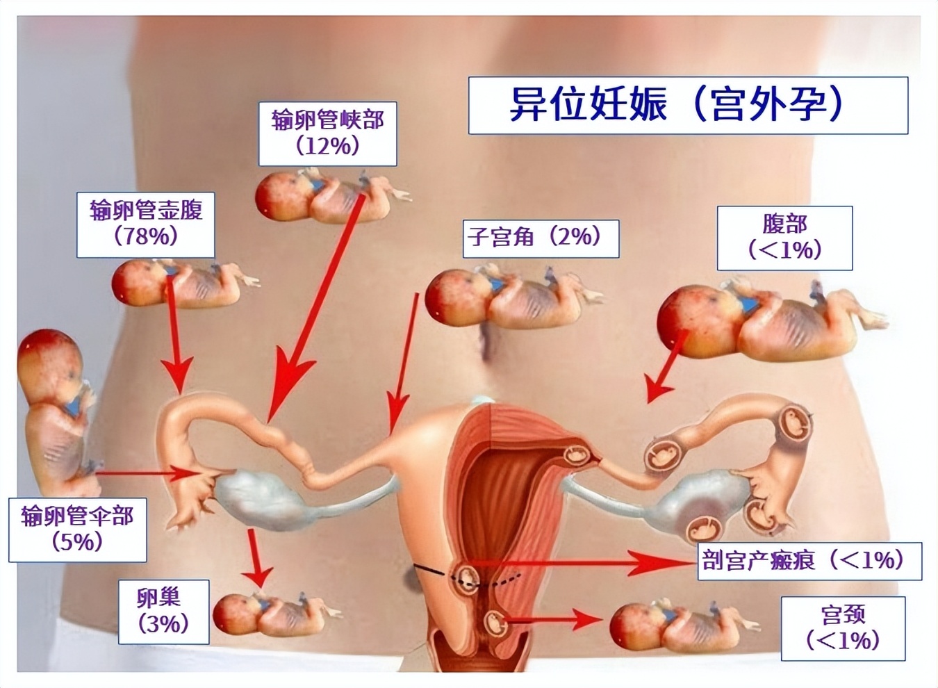 女性上环过程是怎样的,女性上环的全流程