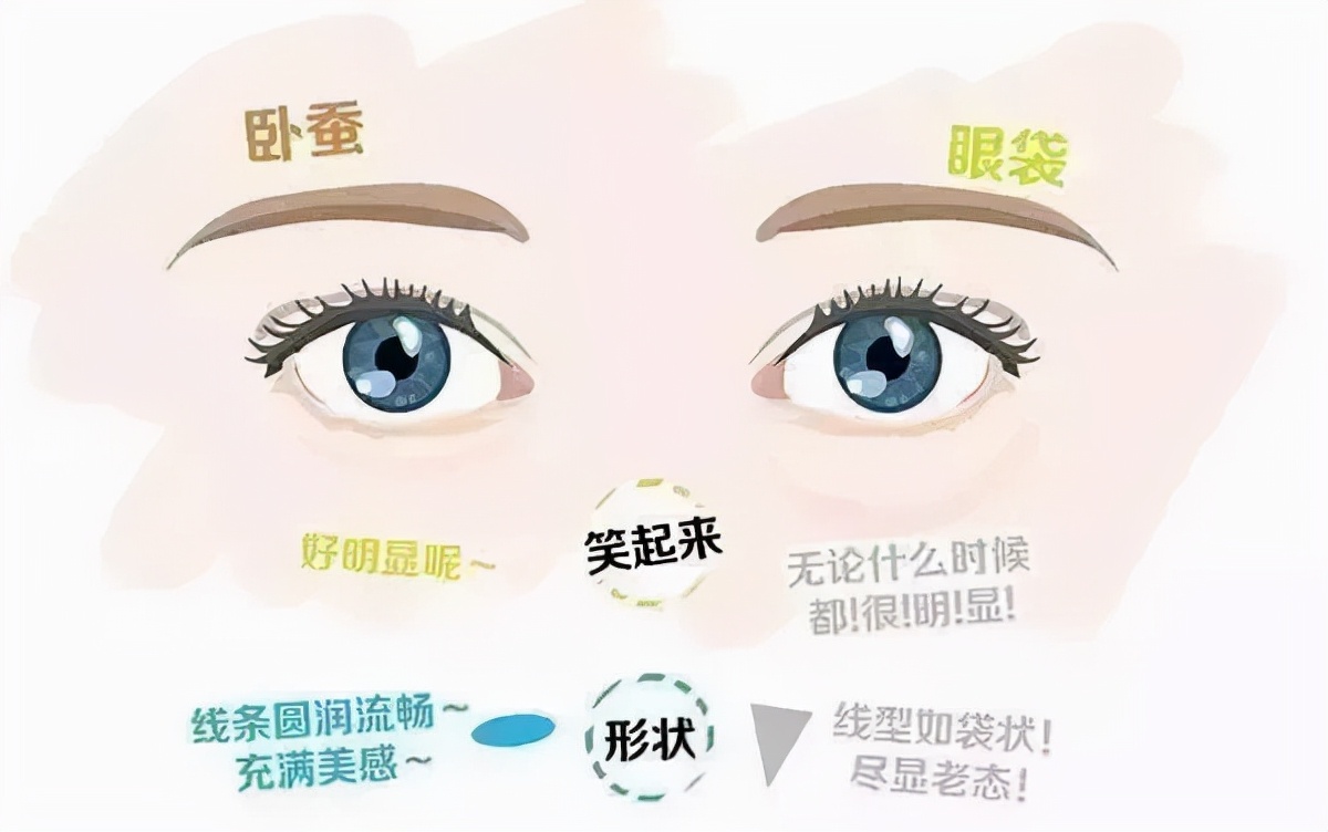 眼袋大怎么办如何解决快又好,眼袋大很显老小妙招