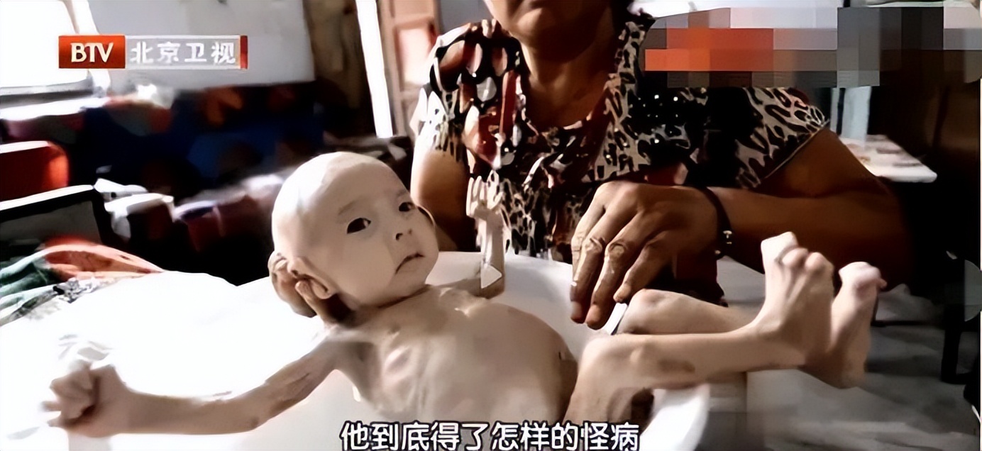 宝宝出生4.3斤45厘米,山西一男婴出生3个月体重4斤