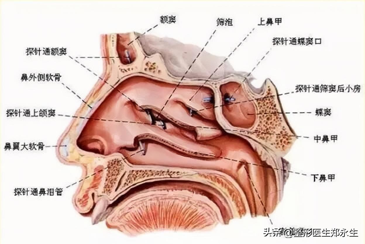 30岁小伙鼻中隔偏曲、鼻甲消融后，鼻梁塌陷嗅觉减退，还有救吗？