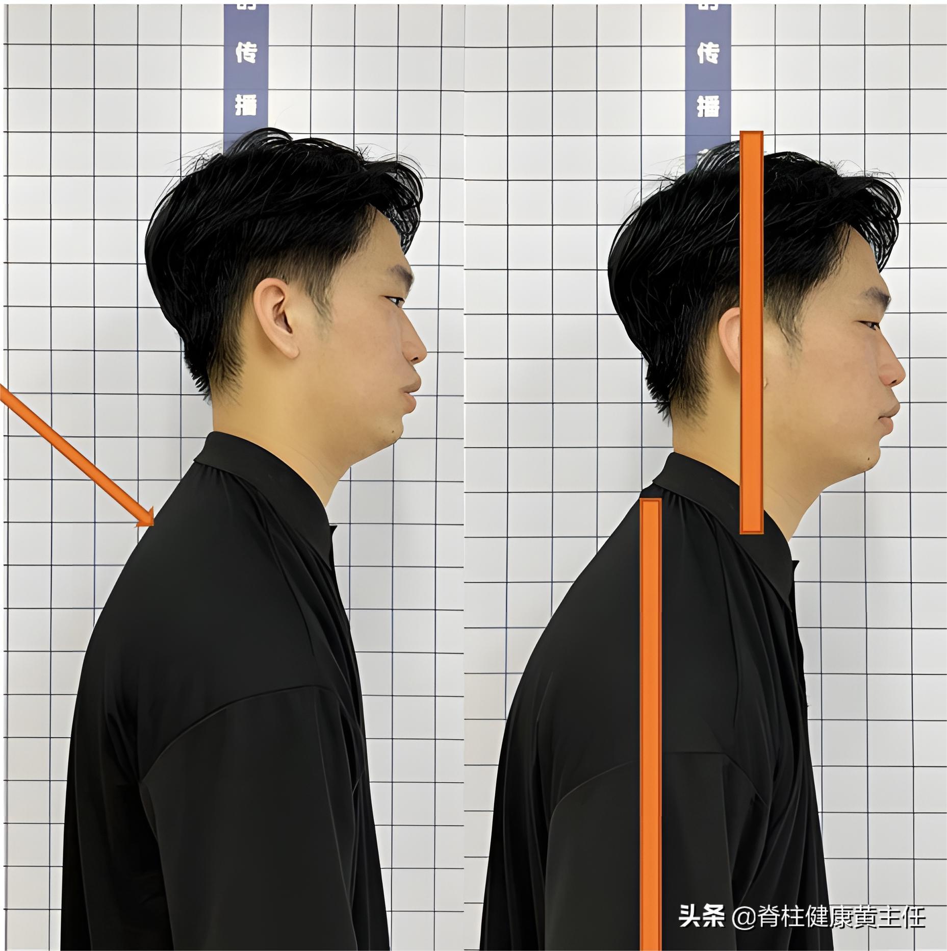 颈椎酸怎么办快速缓解疼痛,颈椎感觉酸乏吃什么药