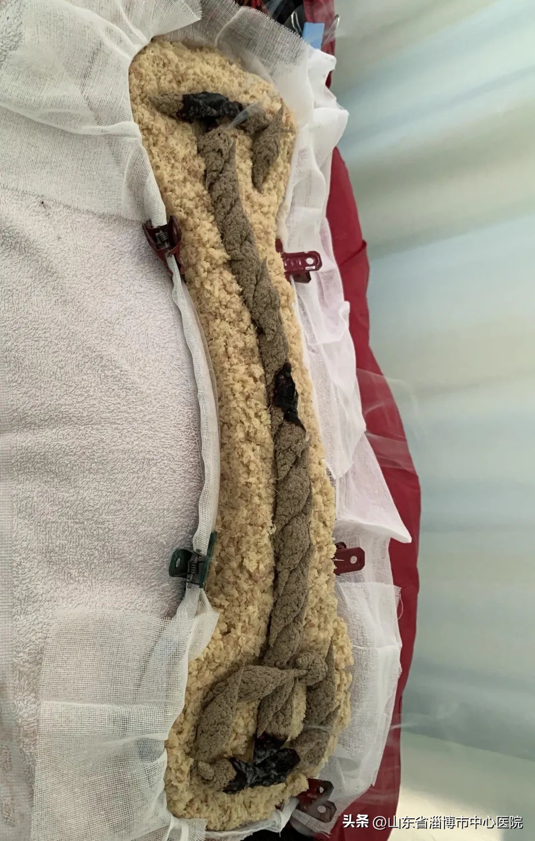 颈部一根筋痛怎么治疗,颈部僵硬紧绷吃什么中药