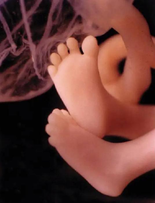 顺产为什么总是头先出来,顺产时胎儿面部向上还是向下