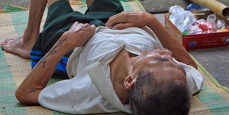 胡希恕治疗糖尿病的经方,糖尿病手脚麻木最佳疗法